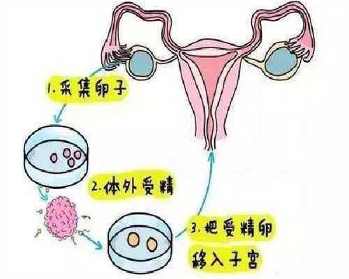 南京有人代孕吗,双胞胎北京代生,(广州代生机构)北京代生机构排名？附试管代